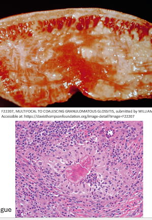 <ul><li><p>pyogranulomatous glossitis/stomatitis with severe fibrosis </p></li><li><p>coccobaculli surrounded by Splendore-Hoeppi material (club colonies or sulfur granules) </p></li></ul><p></p>