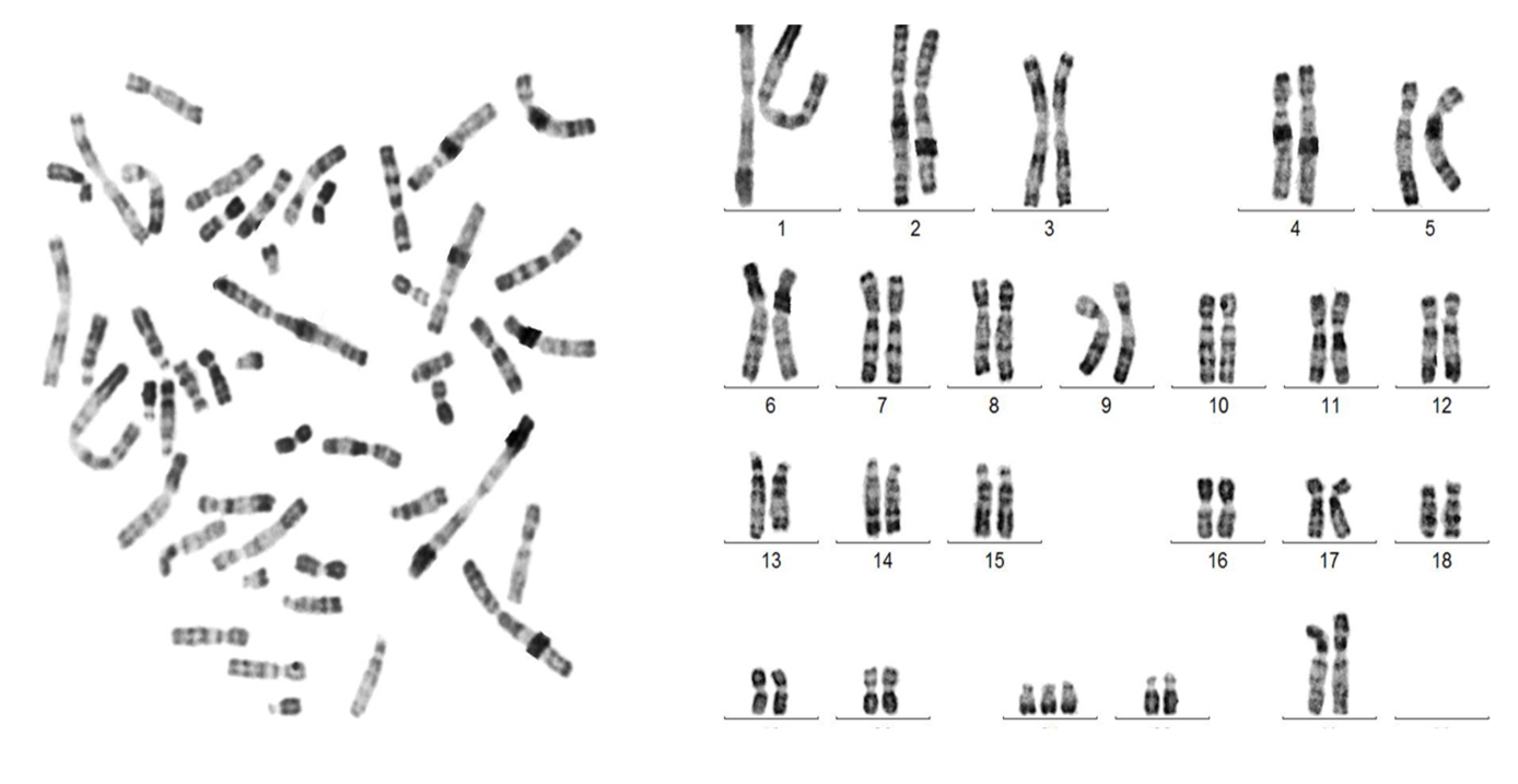 Karyotype Diagram