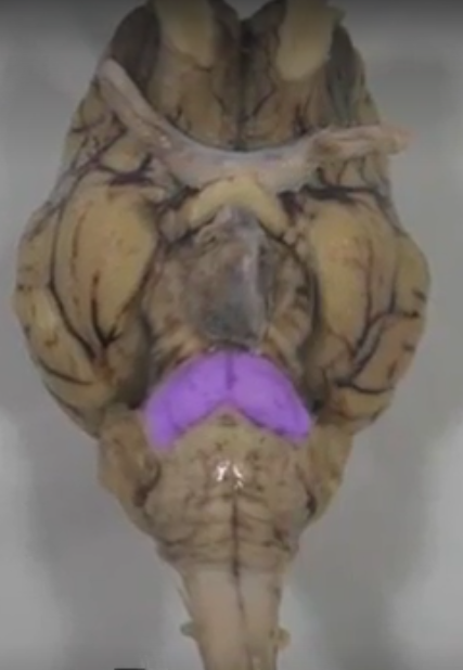 what part of the brain is this?