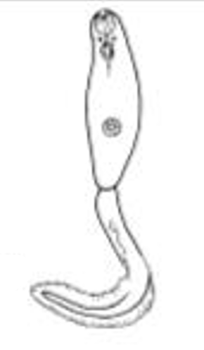 <p>Identify the type of Cercaria based on its Tail</p>