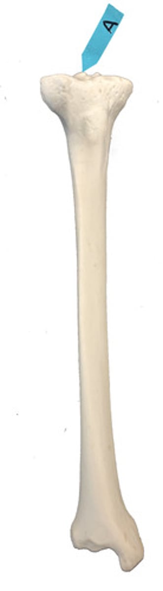 <p>Identify this bone marking.</p>