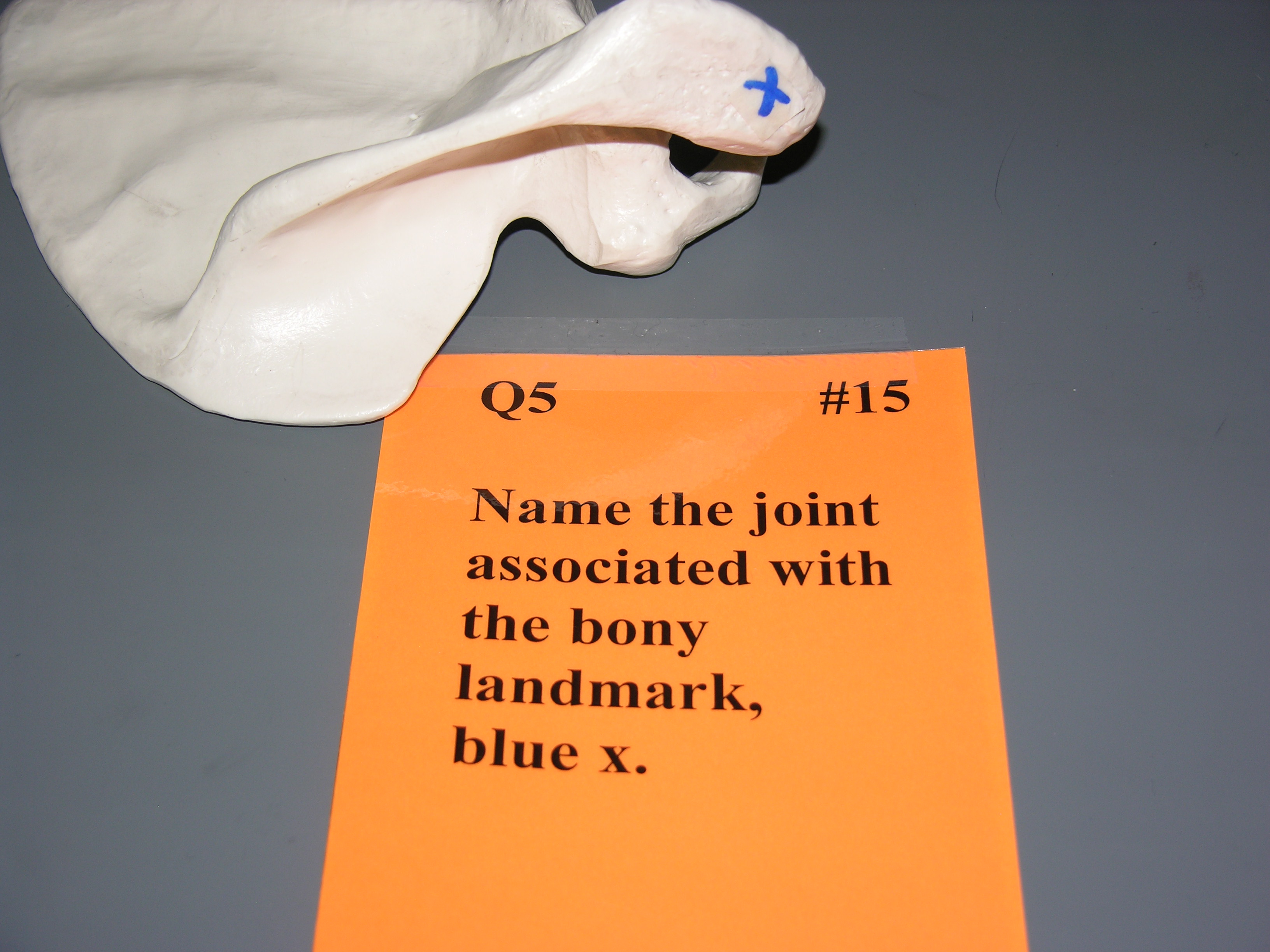<p><span style="font-family: Lato Extended, Lato, Helvetica Neue, Helvetica, Arial, sans-serif; color: rgb(45, 59, 69)">Name the joint associated with the bony landmark indicated by the blue x.</span></p>