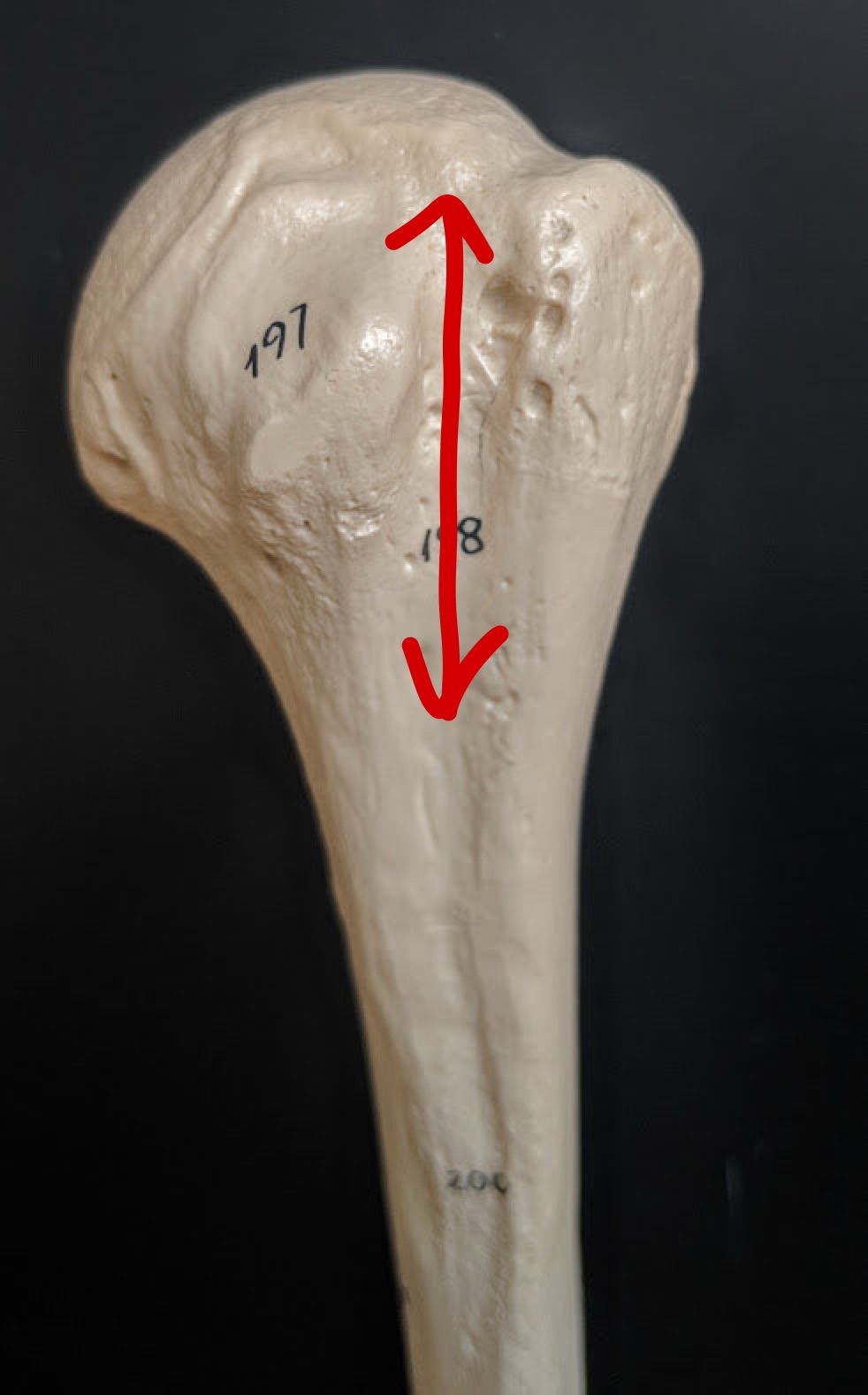 <p>Name this structure</p>