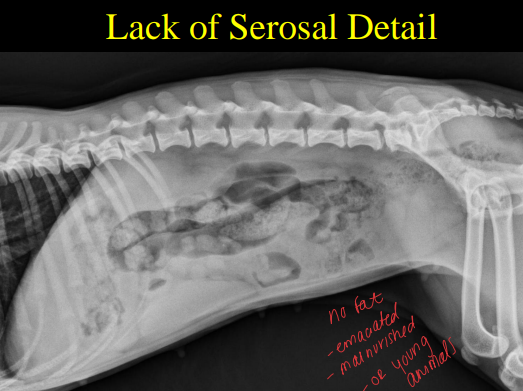 <p>Normal abdomen visible structures on Abdominal Radiographs </p>