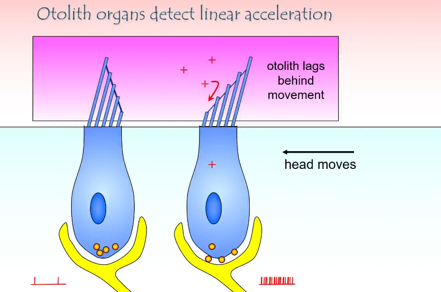 <p></p><ul><li><p>This is the otolith system (utricle + saccule)</p></li><li><p>It shows how the ear detects linear acceleration (moving in a straight line) and head tilt</p></li></ul><p></p><p></p><p><strong>Key structures involved</strong></p><ul><li><p>Hair cells with stereocilia</p></li><li><p>Otolithic membrane (gel-like layer)</p></li><li><p>Otoconia (otoliths) on top of the membrane</p></li><li><p>Endolymph around the stereocilia</p></li><li><p>Afferent vestibular nerve fibres at the base</p></li></ul><p></p><p></p><p><strong>What happens when the head starts moving</strong></p><ul><li><p>The head moves (arrow in the diagram)</p></li><li><p>The otolithic membrane + otoconia lag behind</p></li><li><p>This lag happens because otoconia have mass and inertia</p></li><li><p>As a result, the otolithic membrane shifts relative to the hair cells</p></li></ul><p></p><p><strong>How hair cells are activated</strong></p><ul><li><p>Movement of the otolithic membrane bends the stereocilia</p></li><li><p>If stereocilia bend towards the tallest cilium:<br></p><ul><li><p>Mechanically gated K⁺ channels open</p></li><li><p>K⁺ enters from endolymph</p></li><li><p>Hair cell depolarises</p></li><li><p>More neurotransmitter released</p></li><li><p>Afferent firing increases</p></li></ul></li></ul><p></p><ul><li><p>If stereocilia bend away from the tallest cilium:</p><p></p><ul><li><p>Channels close</p></li><li><p>Hair cell hyperpolarises</p></li><li><p>Less neurotransmitter released</p></li><li><p>Afferent firing decreases</p></li></ul></li></ul><p></p><p><strong>What the + signs and spikes mean</strong></p><ul><li><p>+ signs = depolarisation of the hair cell</p></li><li><p>More spikes = increased firing in the vestibular nerve</p></li><li><p>Fewer spikes would indicate inhibition</p></li></ul><p></p><p><strong>Why “lag” is essential</strong></p><ul><li><p>If the otolithic membrane moved exactly with the head, nothing would bend</p></li><li><p>The lag is what converts motion into a signal</p></li><li><p>This allows detection of:<br></p><ul><li><p>Starting to move</p></li><li><p>Stopping</p></li><li><p>Speed changes</p></li><li><p>Direction of movement</p></li></ul></li></ul><p></p><p></p>