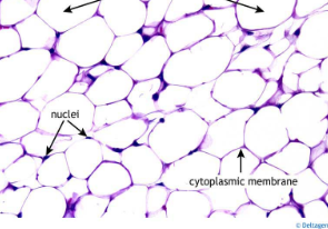 <ul><li><p><span style="background-color: transparent; font-family: "Book Antiqua", serif;"><span>Fat tissue</span></span></p></li><li><p><span style="background-color: transparent; font-family: "Book Antiqua", serif;"><span>Contains a large vacuole of oil</span></span></p></li><li><p><span style="background-color: transparent; font-family: "Book Antiqua", serif;"><span>Functions</span></span></p><ul><li><p><span style="background-color: transparent; font-family: "Book Antiqua", serif;"><span>Energy</span></span></p></li><li><p><span style="background-color: transparent; font-family: "Book Antiqua", serif;"><span>Absorb shock</span></span></p></li><li><p><span style="background-color: transparent; font-family: "Book Antiqua", serif;"><span>Insulate and maintain temperature</span></span></p></li></ul></li></ul><p></p>