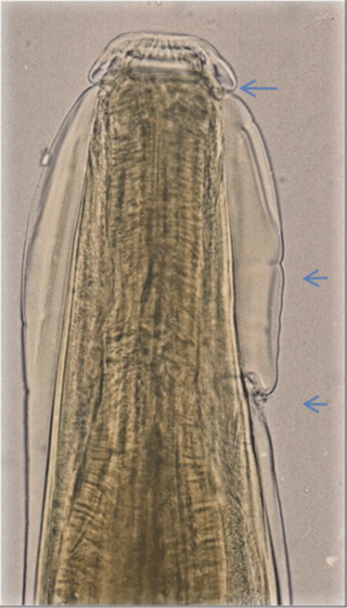 <p>What is this parasite? What characteristic/s did you use to identify it?</p>