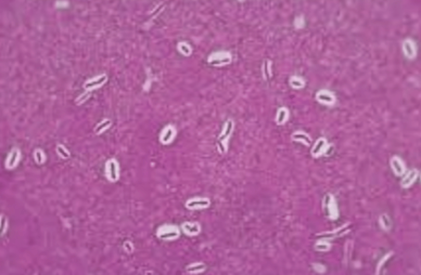 <p>what do we see here in white?</p>