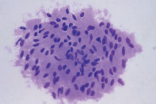 Figure 16: Spindle-shaped cells