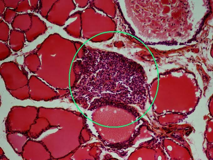 <p><span><span>Name a hormone produced by the indicated endocrine gland.</span></span></p>