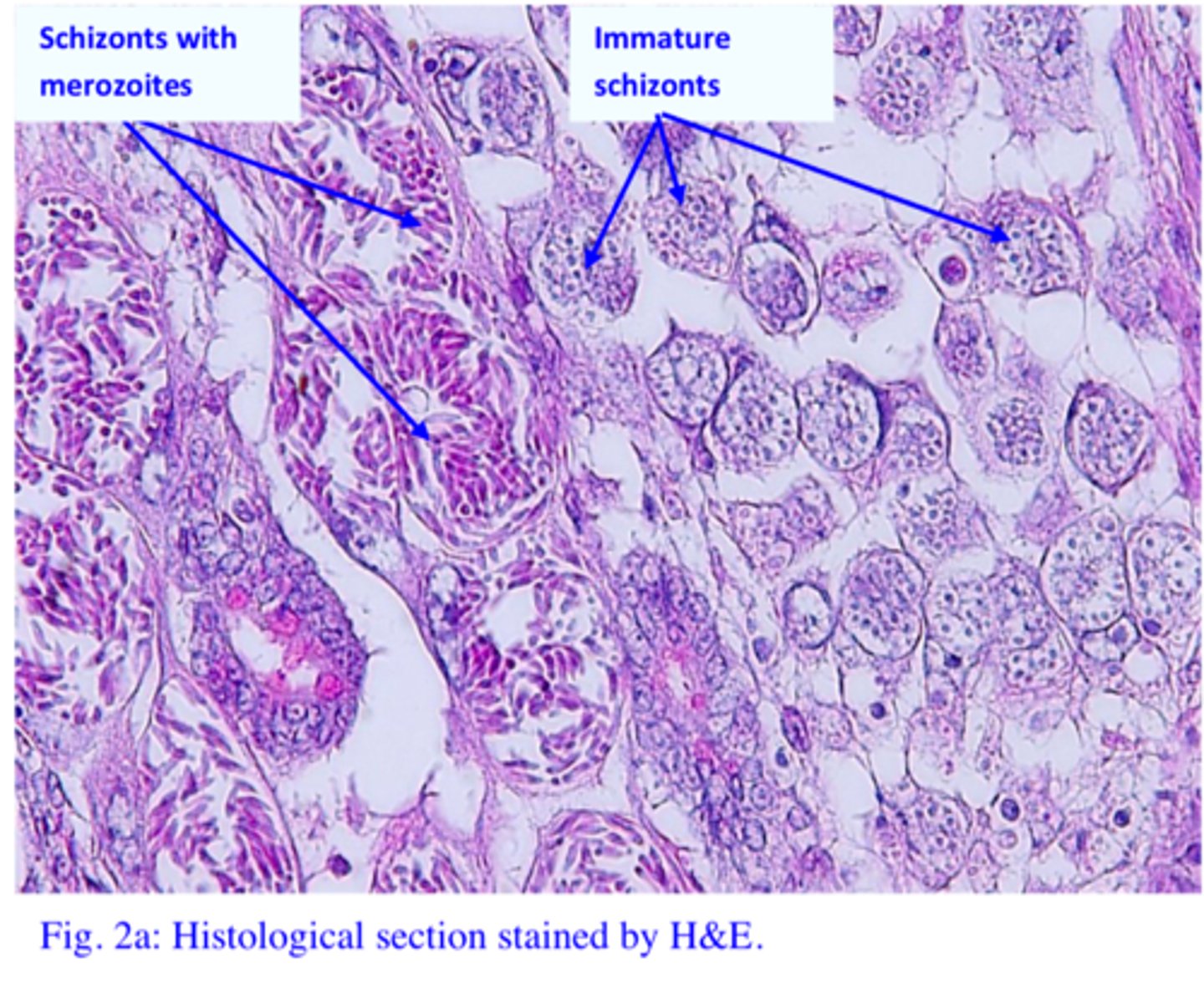 <p></p><p>Q2: What parasite stages are associated with pathology for Eimeria tenella? Identify them on the microscope slide (microscope 1) and on Fig. 2a.</p>