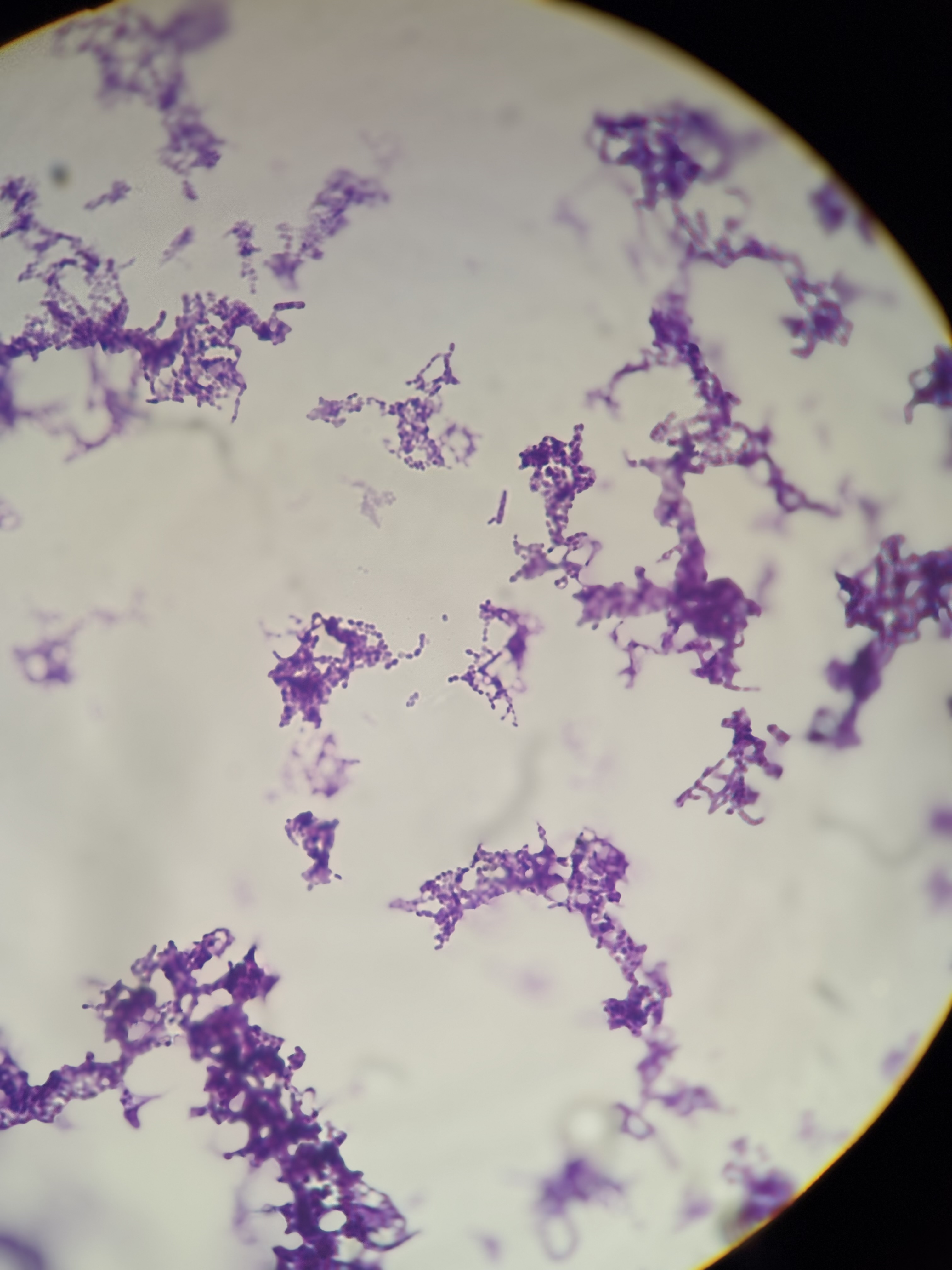 <p>S. pneumoniae</p>