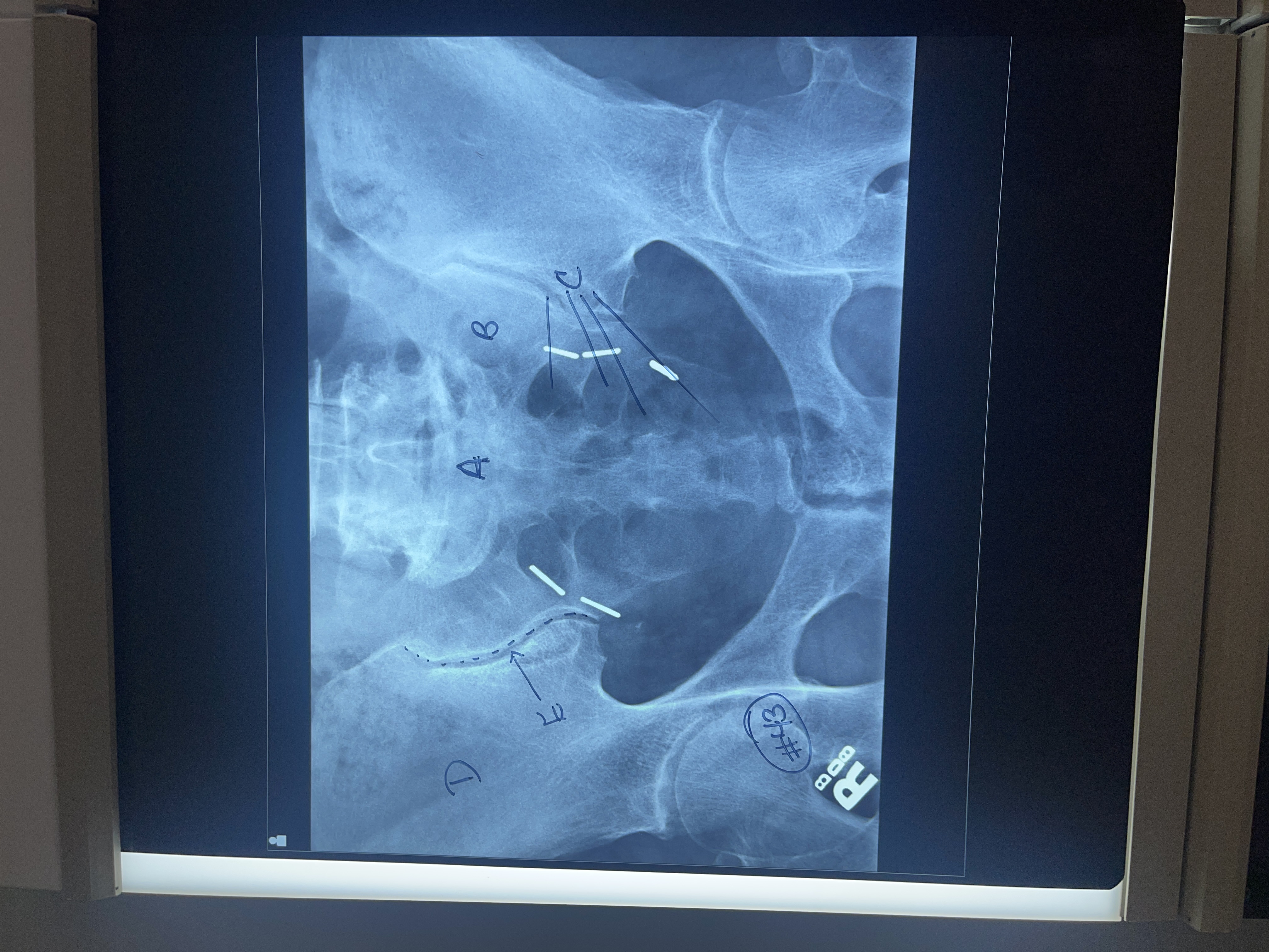 <p>Label #43 AP axial sacrum</p>
