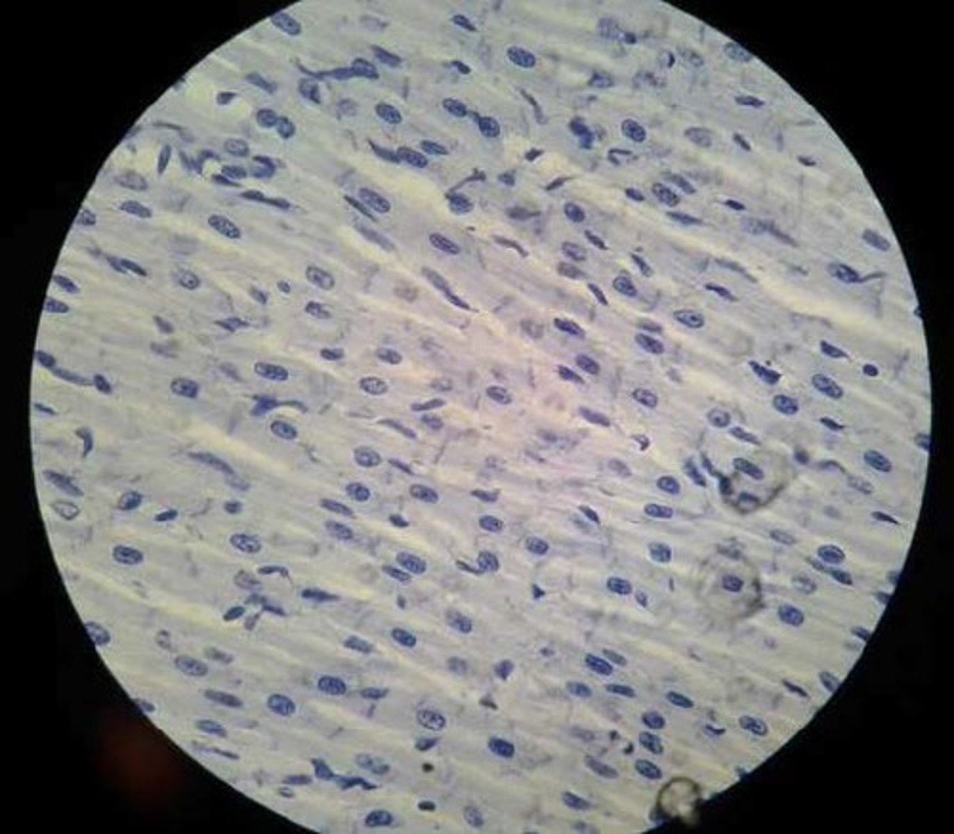 <p>tissue is striated and involuntary (contains intercalated discs)</p><p>Location: Heart Muscle</p><p>Function: Heart movements</p>