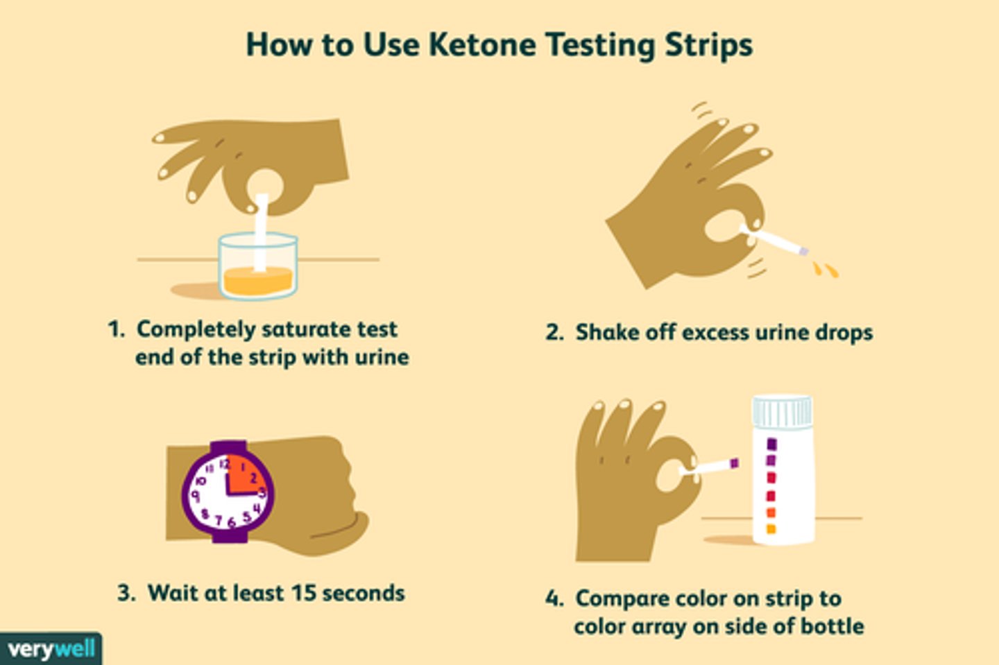 <p>- with a urine ketone strip</p><p>- monitor levels (range of negative => trace => large)</p><p>- if rising ketones = Intervene!</p><p>- note* high ketones seen in ketoacidosis (diabetic ketoacidosis = DKA)</p>