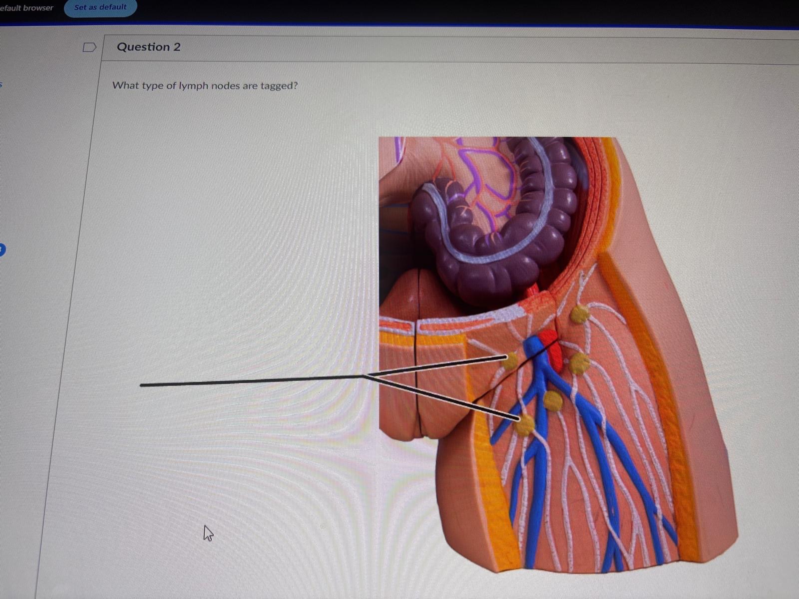 <p><span>What type of lymph nodes are tagged?</span></p>