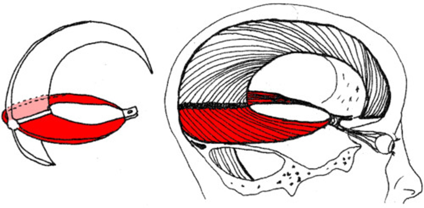 <p>separates cerebrum from cerebellum</p>