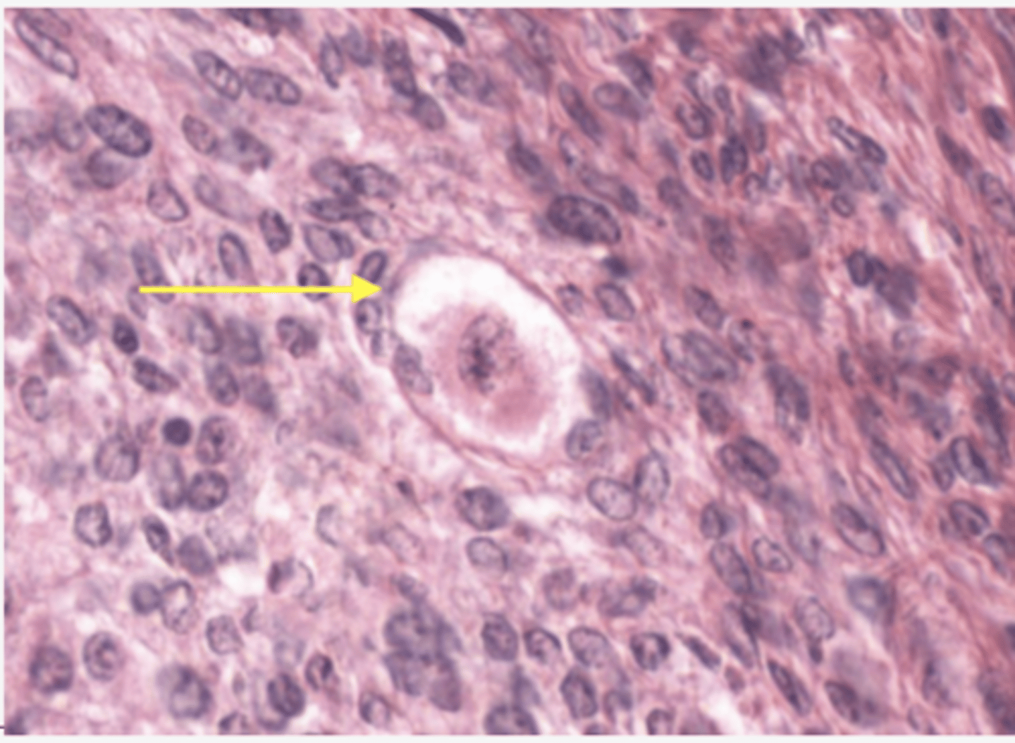 <p>Identify the stage of the follicle</p>