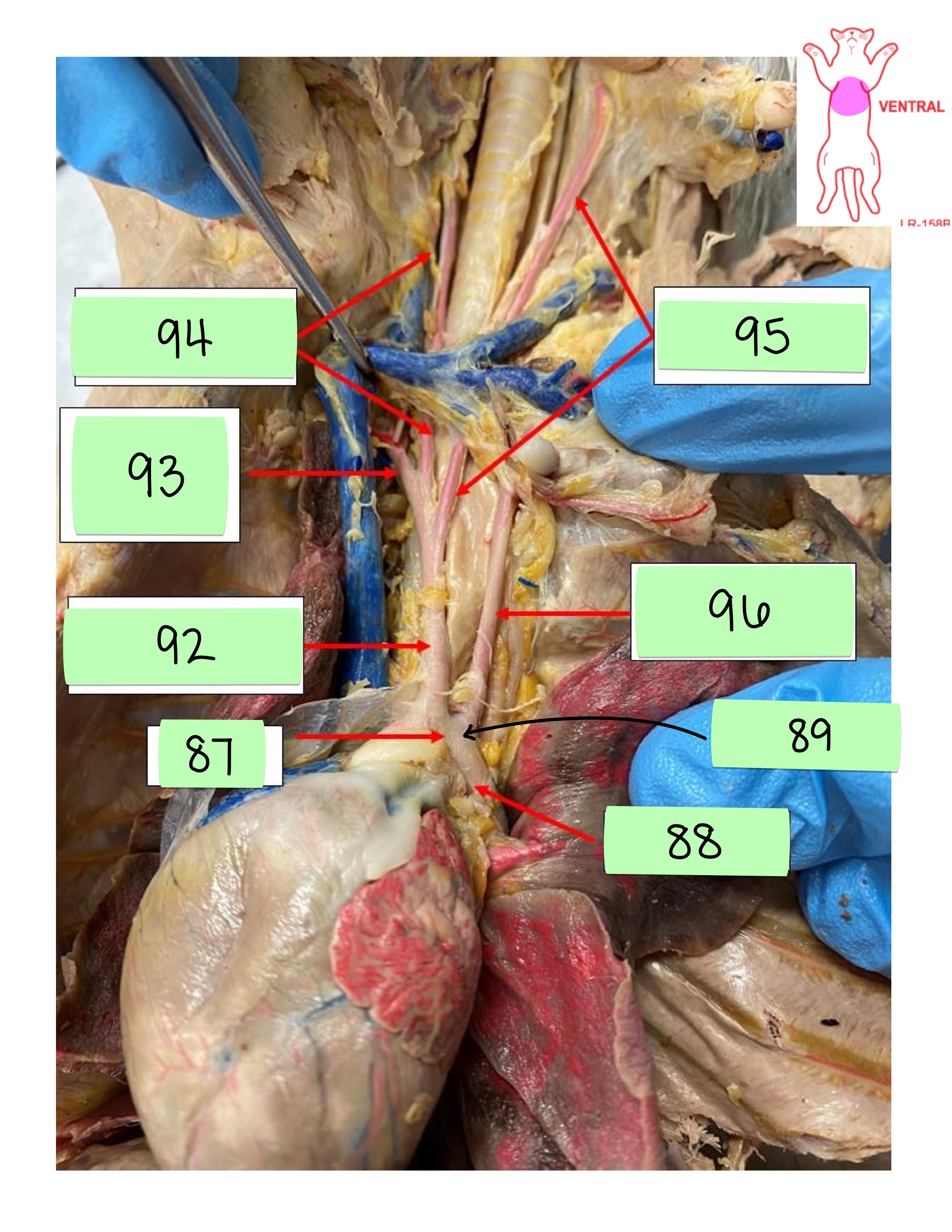 <p>left subclavian artery</p>