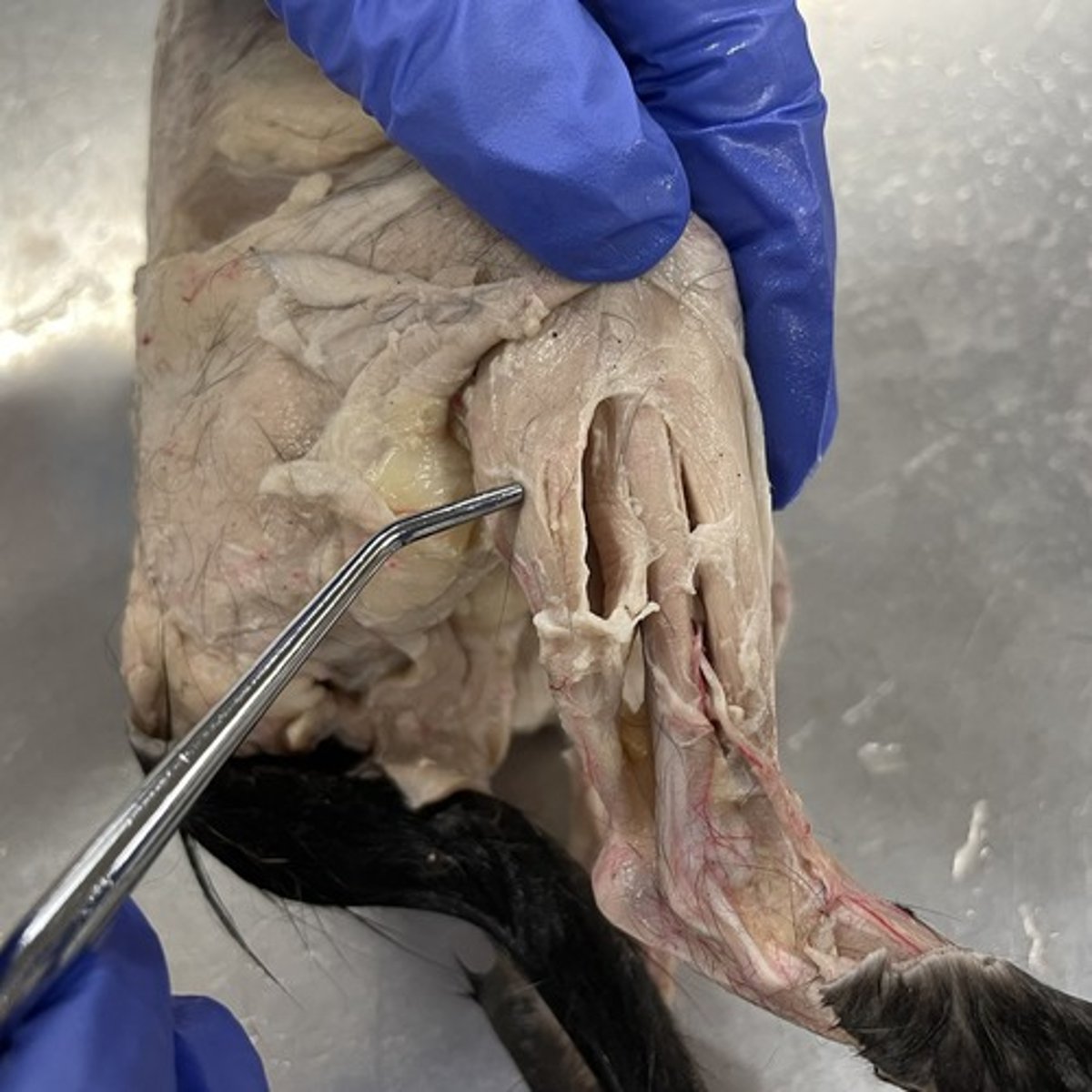 <p>O: lateral epicondyle of femur; medial epicondyle of femur</p><p>I: calcaneus via the calcaneal tendon (achilles tendon)</p><p>A: plantar flexion</p>