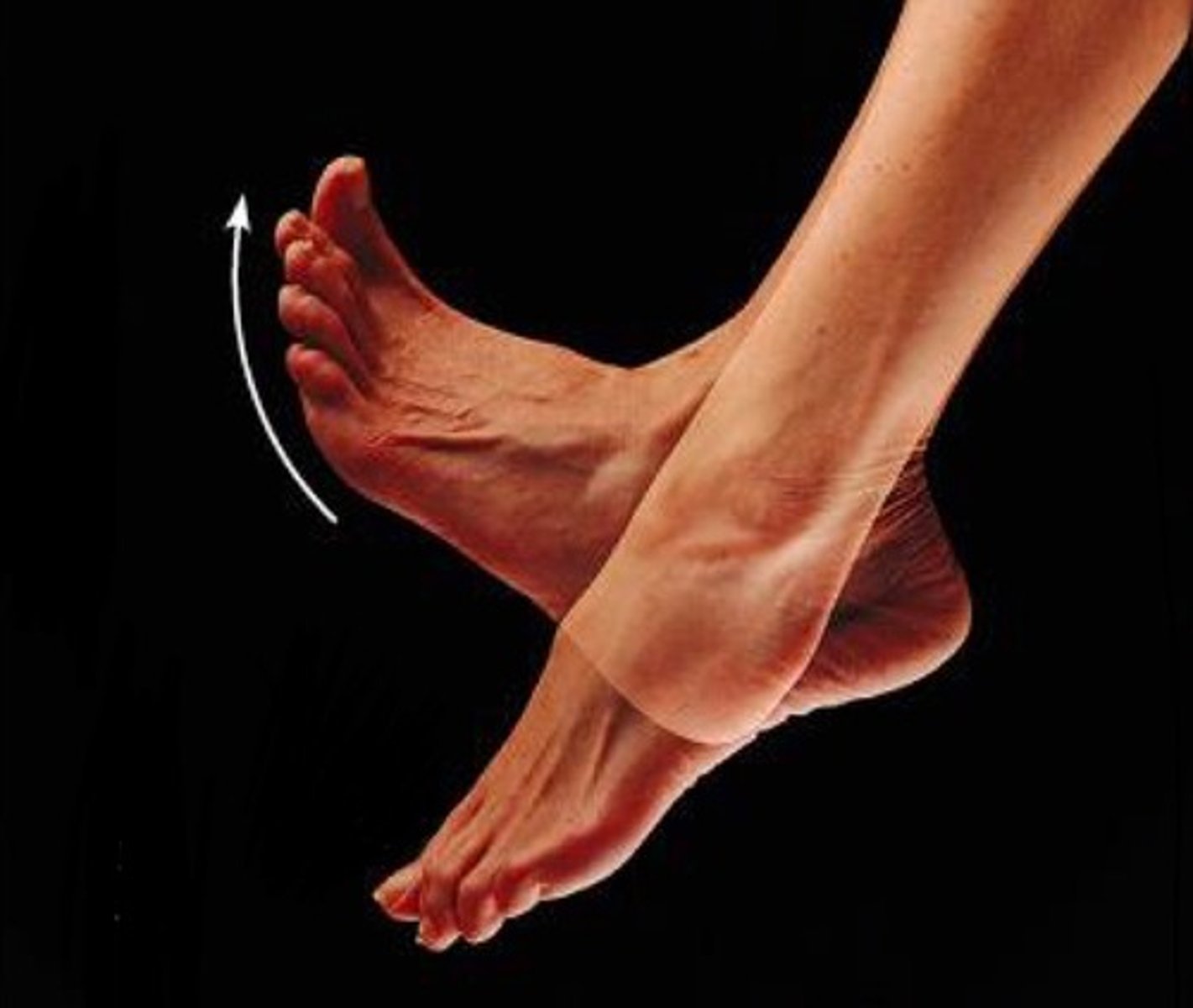 <p>flexing the foot at the ankle towards the shin</p>