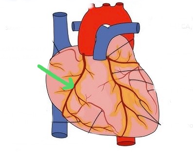 <p>Supplies right atrium, right ventricle, and part of septum.</p>