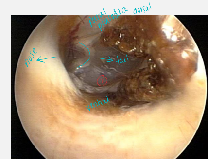 <p><span>Otitis</span></p>