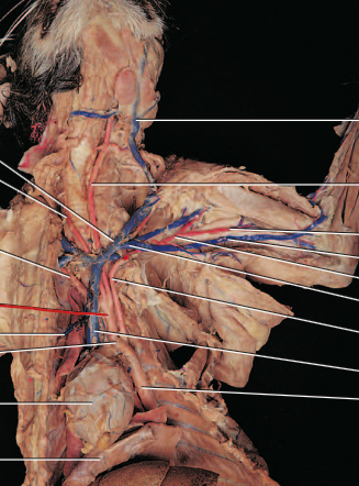<p><span>Carries oxygenated blood to the upper right side of the body</span></p>