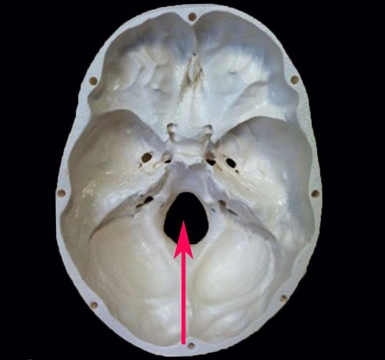 <p>hole in a bone</p>