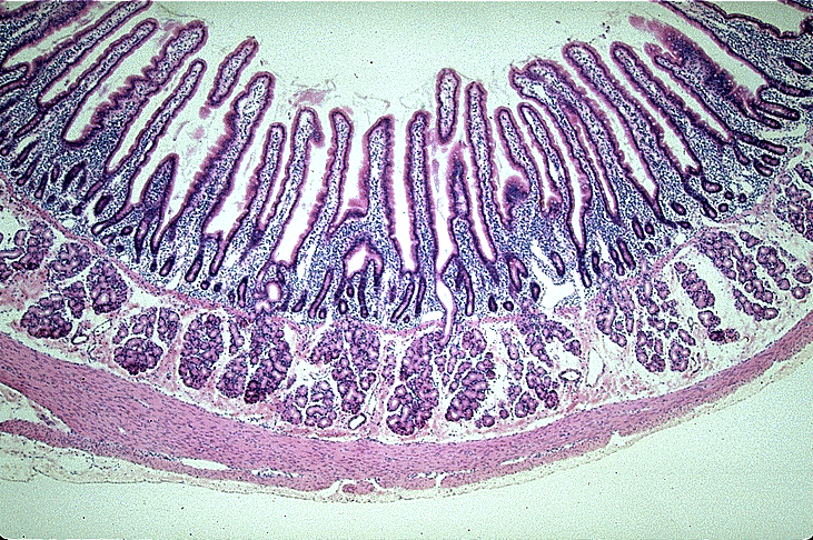 <p>-most absorption occurs here</p><p>-Brunner’s glands: secrete alkaline mucus (neutralizes chyme’s pH)</p><p>- Papilla</p><p>-Plica (circular folds), villi, &amp; microvilli/brushborder</p><p>-Point where pancreatic enzymes and bile are released</p><p>-lacteals absorb fat</p><p>(simple columnar)</p>