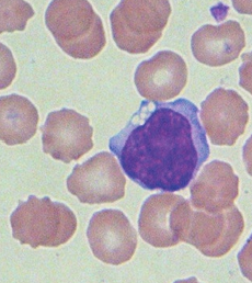 * Most commonly an aging artifact
  * Avoid by sending PTT and blood smear
* Some of the lysosomal storage disorders (inherited)
* Ingestion of plants containing swainsonine (acquired)
  * Locoweed toxicity
