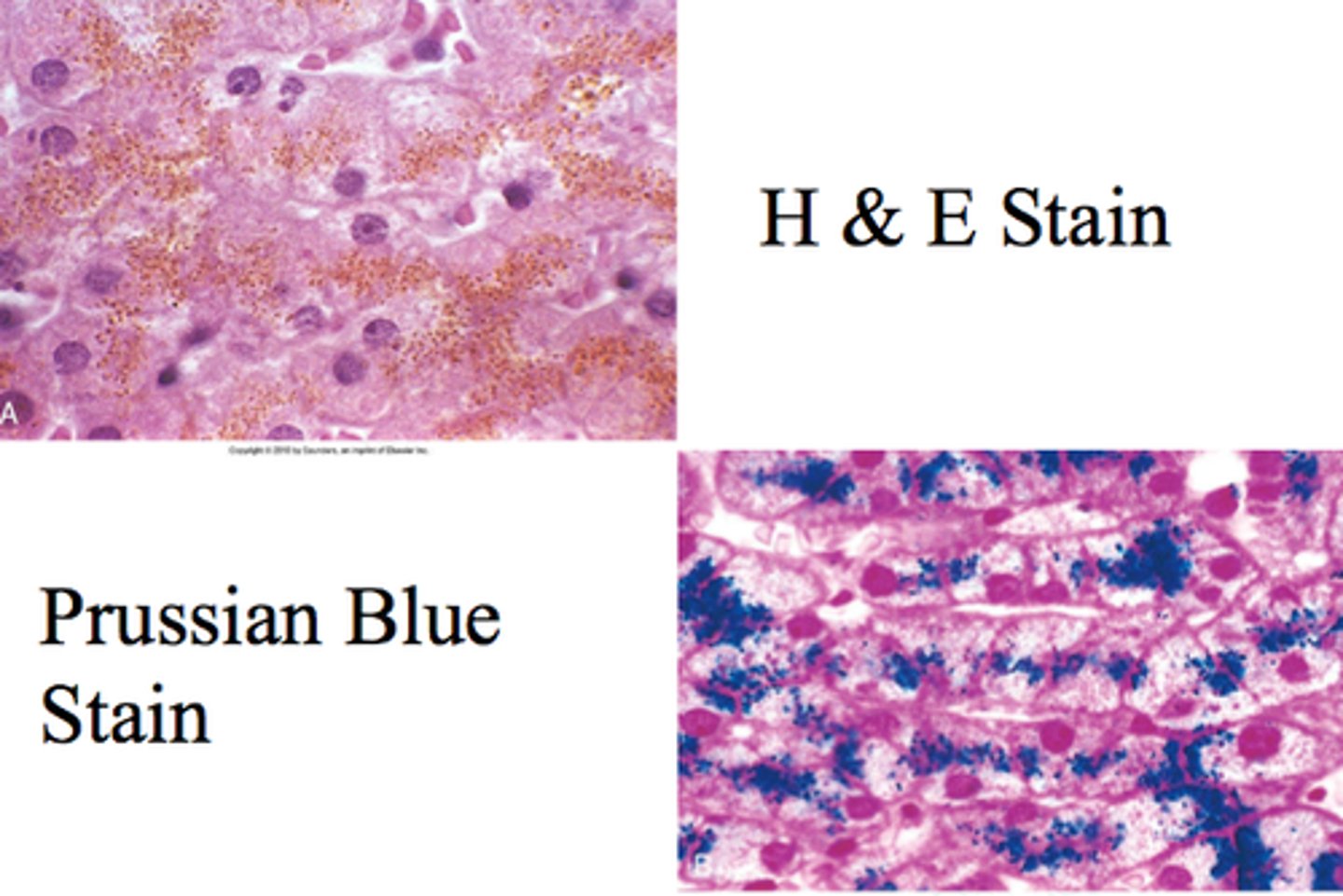 <p>Prussian blue stain</p>