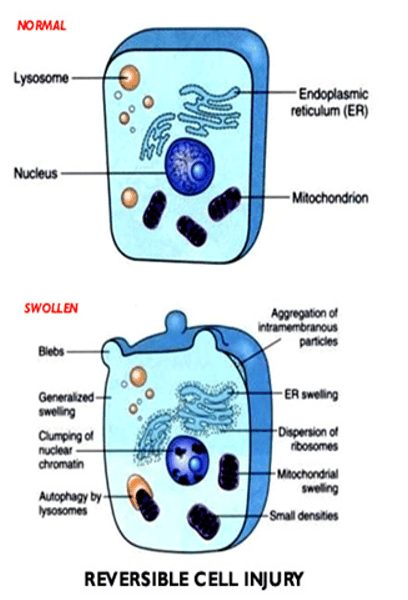 <p>blebbing, blunting, and loss of microvilli</p>