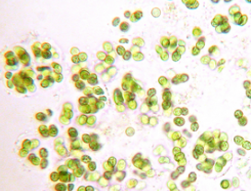 <p>cyanobacteria that are found as individuals or in small clusters. Their gelatinous sheaths give the cells a “glowing” appearance </p>