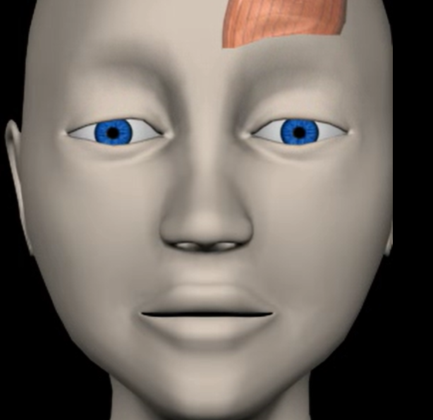<p>Function: elevates eyebrows</p><p>Origin: epicranial aponeurosis</p><p>Insertion: skin of eyebrows</p>