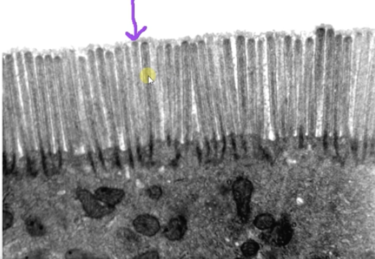 <p>Micro-vi-ll-us/micro-villi</p>