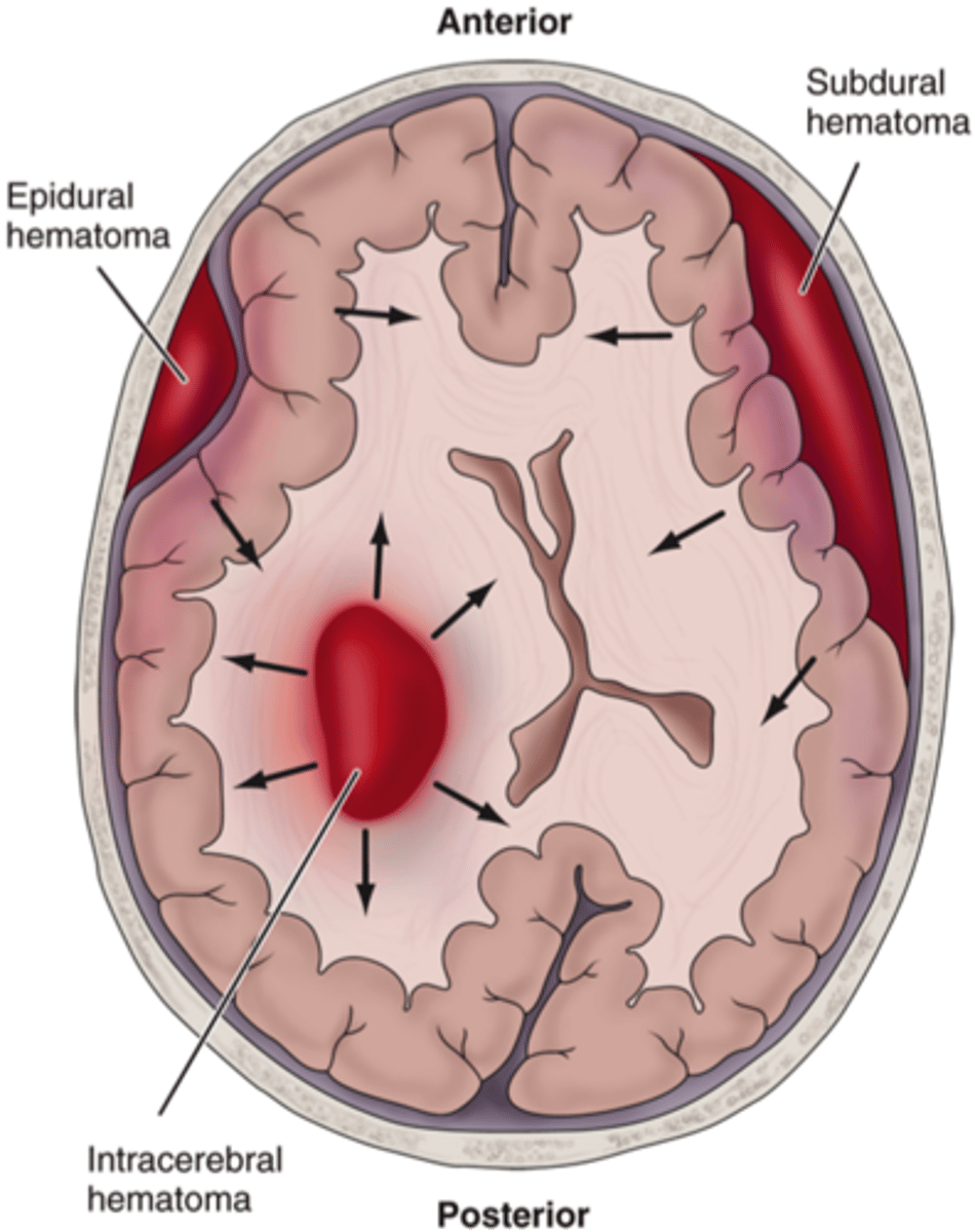 <p>Blow to the head, infection, tumor, stroke, aneurysm, epilepsy, hypoxemia,and meningitis</p>