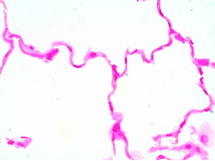 <p>What type of tissue is this?</p>