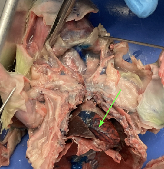<p>(artery)</p>