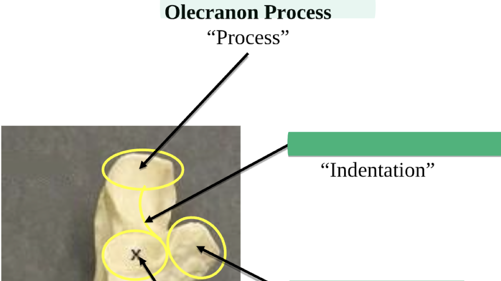 <p>Olecranon Process </p>