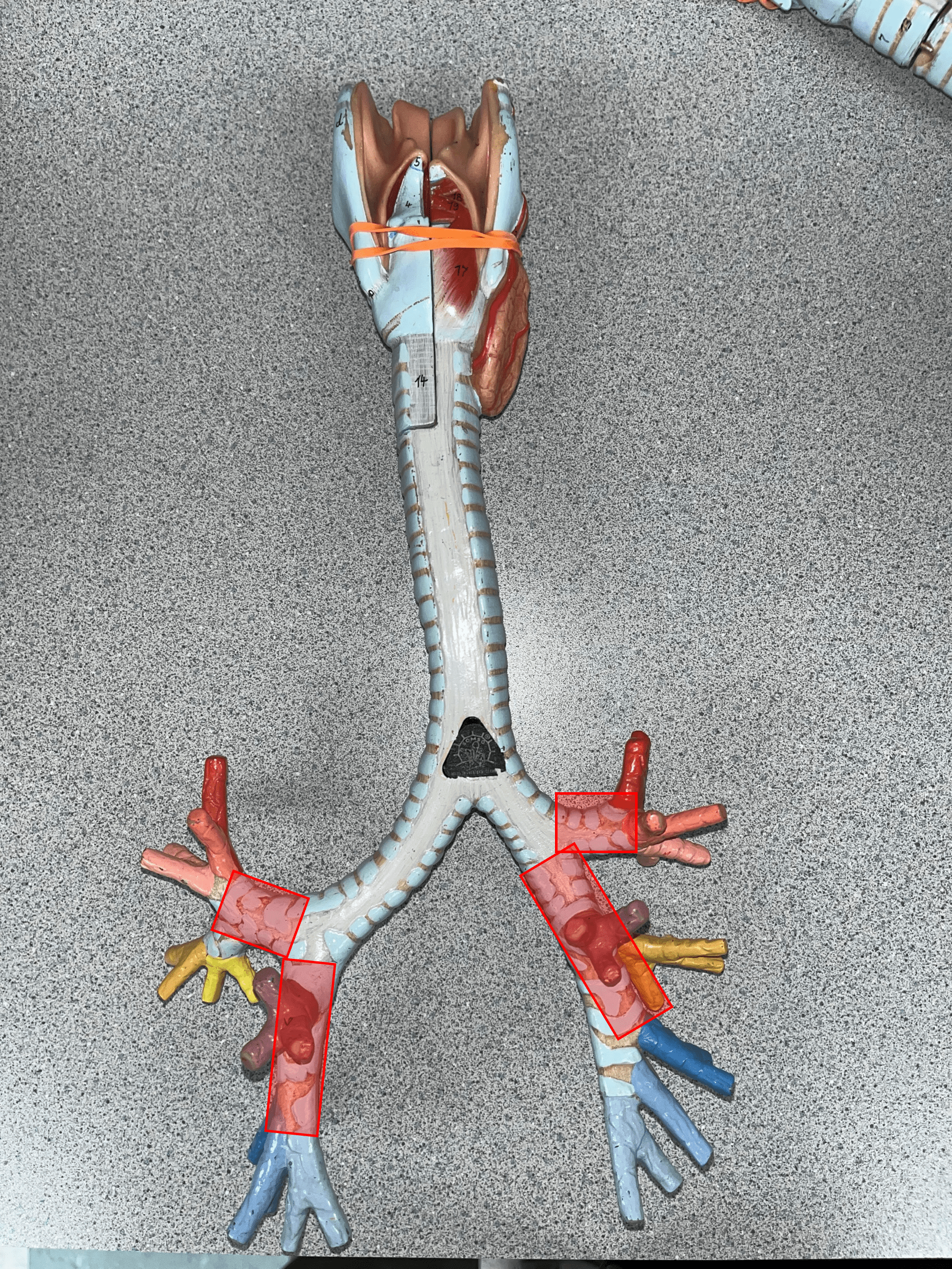 • Smaller branches of a primary bronchus.

• Supplies each lobe of a lung.

• Branches into tertiary bronchi.

• Also known as lobar bronchi.