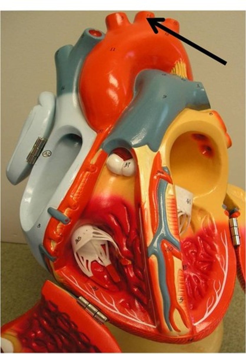 <p>Area supplied: Left side of the head and neck</p><p>Terminal branch: Left internal and external carotid arteries</p><p>Relationship: Bifurcates at the level of the thyroid gland</p>