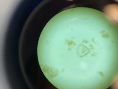 <p>What is the genus species of this tapeworm? Its definitive hosts are cattle, sheep, goats, and llamas. Its intermediate host is grain mites</p>