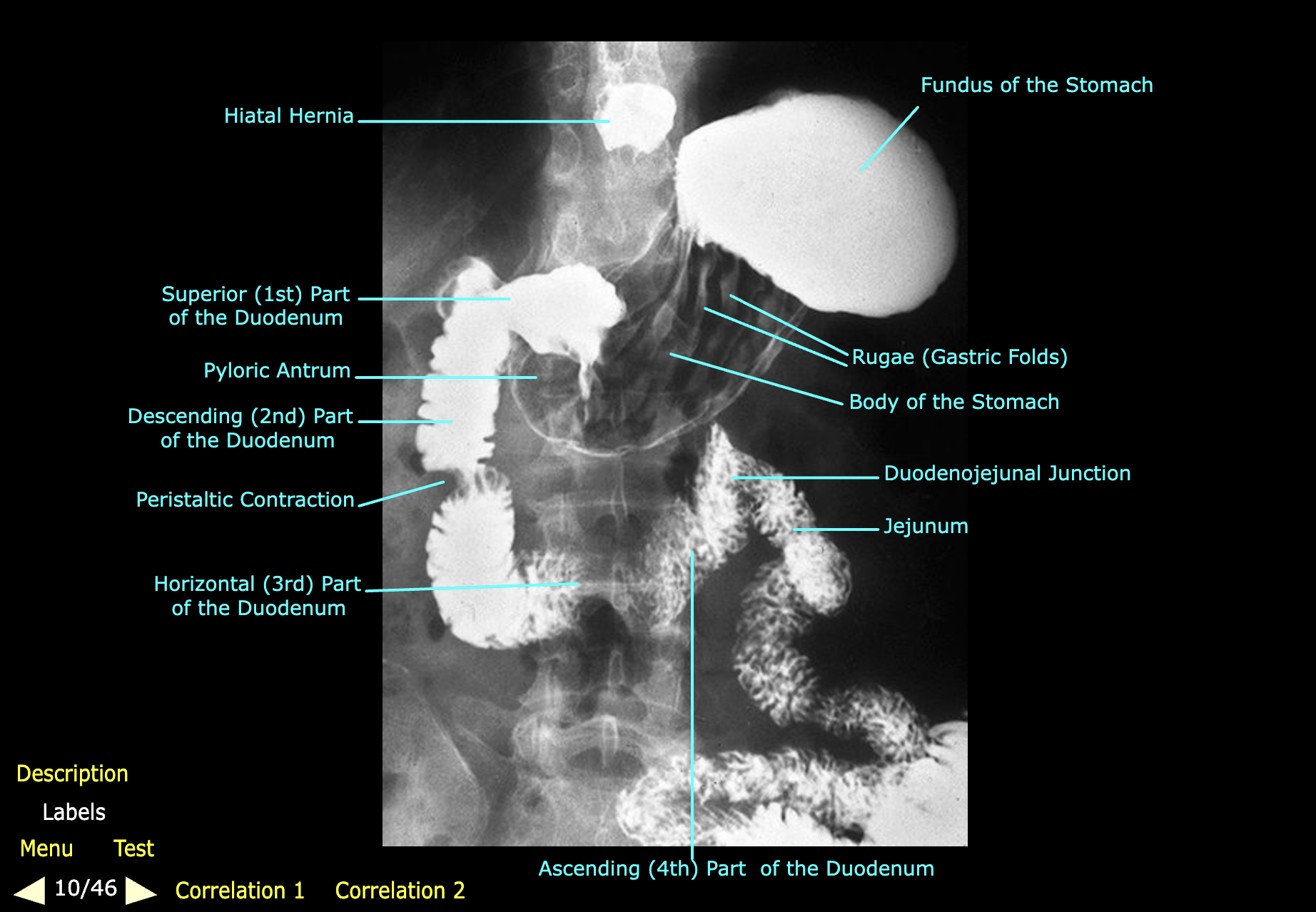 knowt flashcard image