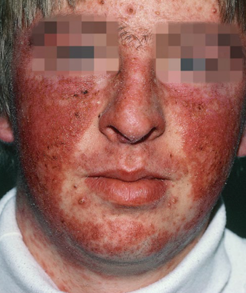 <p>what type of distribution</p>