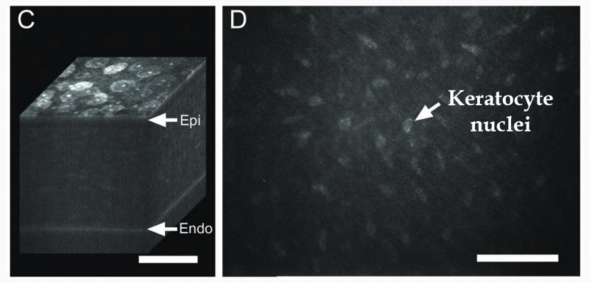 <p>In the cellular tissue due to organelles and nuclei.</p>