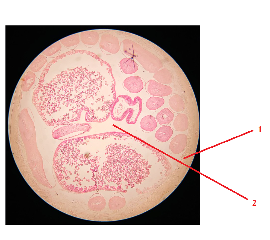 <p>Phylum?<br>Symmetry? Tissue type?<br>Cavity?<br><br>1/2?<br><br>identity?</p>