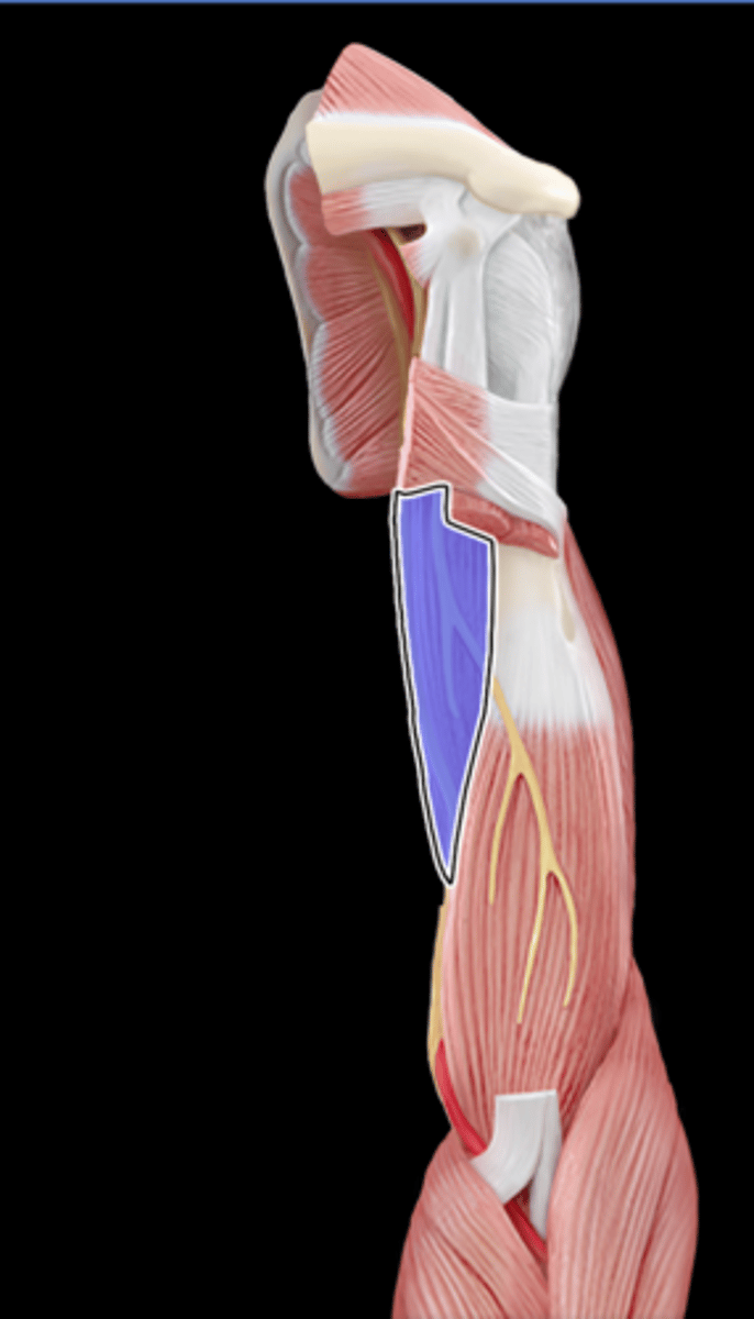 <p>What Muscle Is Highlighted?</p>