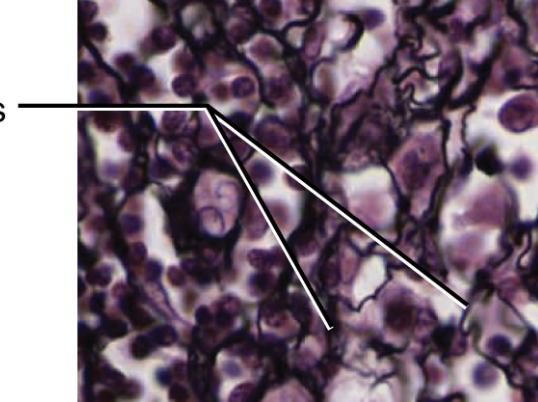 <p>very thin, delicate fibers that form a <strong>branching network</strong> instead of thick bundles like collagen or wavy threads like elastic fibers (like spider-webs)</p>