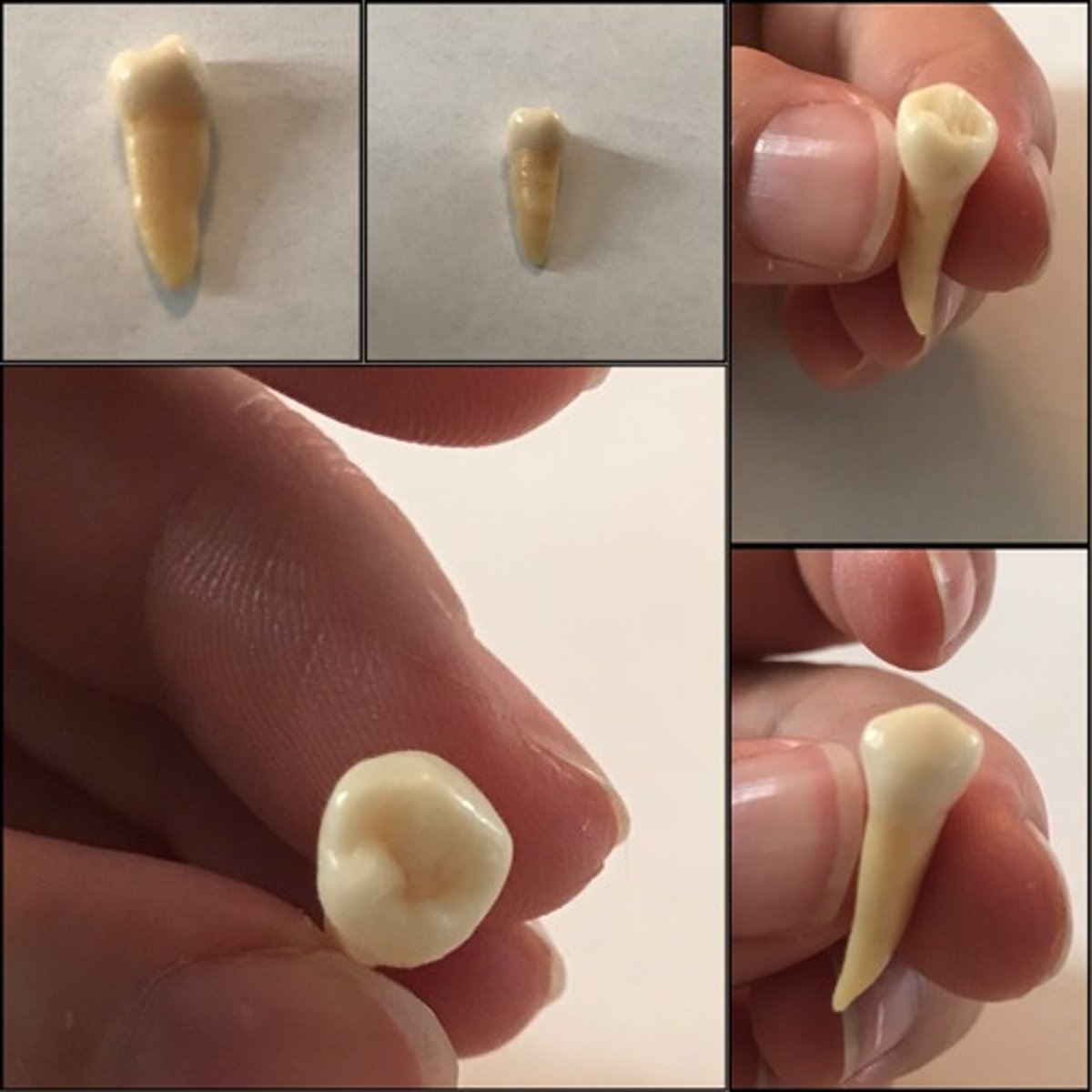 <p>What tooth is this ?</p>